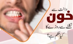 دانت سے خون نکلنے سے روزہ